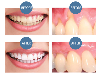 Gum Protect Repair Gel