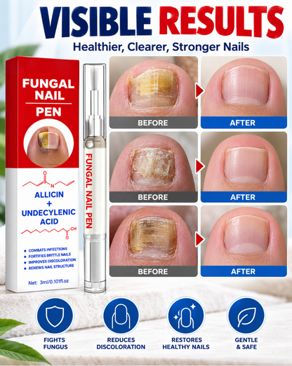 Fungal Nail Care Pen